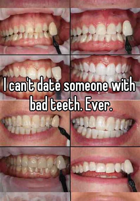 dating someone with rotten teeth
